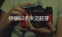懷孕60天未見胚芽