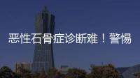 惡性石骨癥診斷難！警惕寶寶的這些異常表現