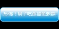 恐怖！男子吃魚被魚刺穿過食道