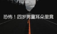 恐怖！四歲男童耳朵里竟卡塊電池