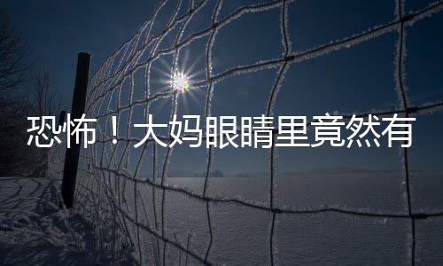 恐怖！大媽眼睛里竟然有活蟲在爬