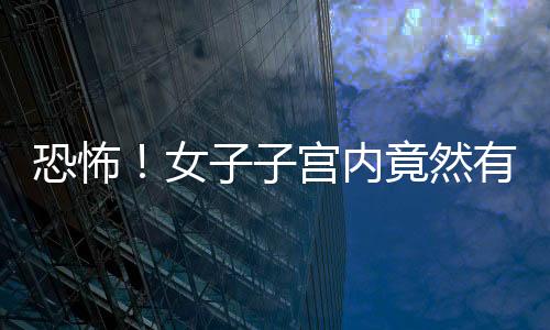 恐怖！女子子宮內(nèi)竟然有66個(gè)肌瘤