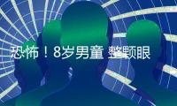 恐怖！8歲男童 整顆眼珠被溶化