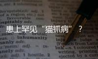 患上罕見“貓抓病”？ 專家提醒：“擼貓”需謹慎