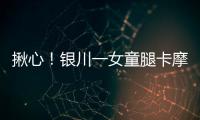 揪心！銀川一女童腿卡摩托車車輪