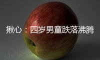 揪心：四歲男童跌落沸騰粥鍋 植皮四次仍未愈