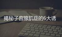 揭秘子宮腺肌癥的6大誘因，預(yù)防從日常生活護(hù)理做起