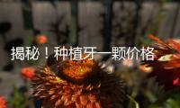 揭秘！種植牙一顆價格，影響價格因素全在這里了！