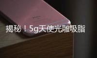 揭秘！5g天使光雕吸脂危險(xiǎn)嗎？無需開刀，輕松塑形，性價(jià)比之選~