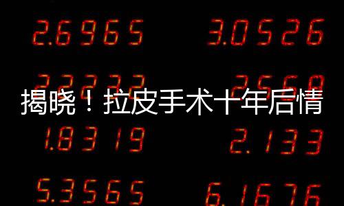 揭曉！拉皮手術十年后情況，依然是同齡人當中的c位