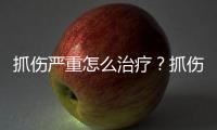 抓傷嚴重怎么治療？抓傷嚴重怎么治療好