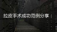 拉皮手術成功范例分享：44歲姐姐做完中下面部拉皮第5年，法令紋還真沒有~
