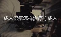 成人濕疹怎樣治療（成人濕疹最佳治療方法）