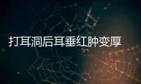 打耳洞后耳垂紅腫變厚 打耳洞后耳垂變厚怎么辦