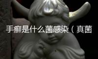 手癬是什么菌感染（真菌感染手癬圖片）
