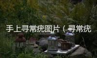 手上尋常疣圖片（尋常疣圖片）