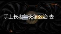 手上長老年斑怎么治 去除老年斑的方法
