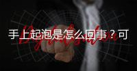手上起泡是怎么回事？可能是濕疹或是汗皰疹，如何鑒別