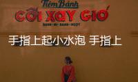 手指上起小水泡 手指上起小水泡應該如何治
