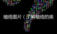暗瘡圖片（了解暗瘡的類型和預(yù)防措施）