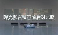 曝光柳巖整容前后對比照及柳巖最近慘敗