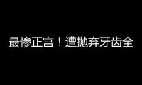 最慘正宮！遭拋棄牙齒全掉暴瘦到44斤，今病情嚴重賣收藏湊藥錢