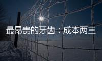 最昂貴的牙齒：成本兩三千 收費上萬