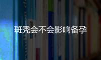 斑禿會(huì)不會(huì)影響備孕