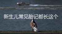 新生兒常見胎記都長這個樣子，圖片參考可以自己對照著看
