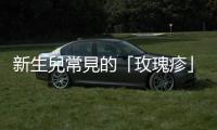 新生兒常見的「玫瑰疹」很可怕嗎？好發年齡、癥狀與預防照護一次看