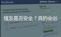 植發(fā)是否安全？真的會出人命嗎？