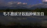 毛不易拔牙致臉腫懶發自拍 遭調侃：這不是理由
