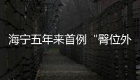 海寧五年來首例“臀位外倒轉”！通過“乾坤大挪移”術的寶寶順產啦~