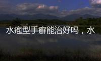 水皰型手癬能治好嗎，水皰型手癬有哪些癥狀