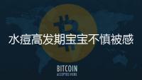 水痘高發期寶寶不慎被感染，3個小技巧讓恢復時間減半