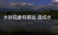 水腫現象有哪些 造成水腫的原因