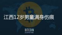 江西12歲男童滿身傷痕慘死家中 疑似遭父母長期虐待