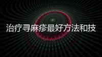 治療尋麻疹最好方法和技巧