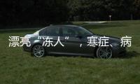 漂亮“凍人”，寒癥、病毒性感染可引起面癱