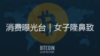 消費曝光臺｜女子隆鼻致鼻腔積液索賠遭拒，美容機構：可重做
