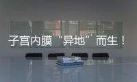 子宮內膜“異地”而生！這種婦科“良性癌”你關注了嗎？