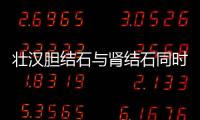 壯漢膽結(jié)石與腎結(jié)石同時(shí)發(fā)作 痛得縮成一團(tuán)
