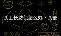 頭上長膿包怎么辦？頭部膿腫的治療方法和預防措施