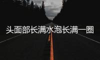 頭面部長(zhǎng)滿水泡長(zhǎng)滿一圈會(huì)死人 真的恐怖嗎