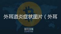 外耳道炎癥狀圖片（外耳道炎癥狀）
