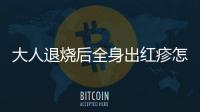 大人退燒后全身出紅疹怎么回事