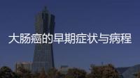 大腸癌的早期癥狀與病程 生活習(xí)慣是預(yù)防關(guān)鍵