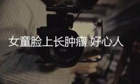 女童臉上長腫瘤 好心人伸援手