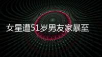 女星遭51歲男友家暴至頭骨骨折，傷勢畫面曝光慘不忍睹