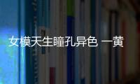 女模天生瞳孔異色 一黃一藍(lán)竟是患了虹膜異色癥
